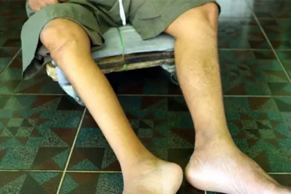 1424087 6833708 05 updates