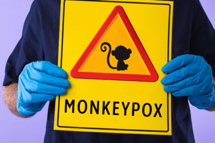 Pakistan Sees Rise in Mpox Cases Two New Cases Detected in KP National Tally Now at 3 1