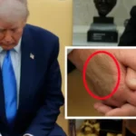 President Trump Diagnosed with Venous Condition Says White House