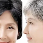 China Develops Breakthrough Cure for Premature Grey Hair