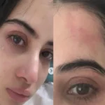 Urfi Javeds Tearful Photo with Injury Sparks Concern