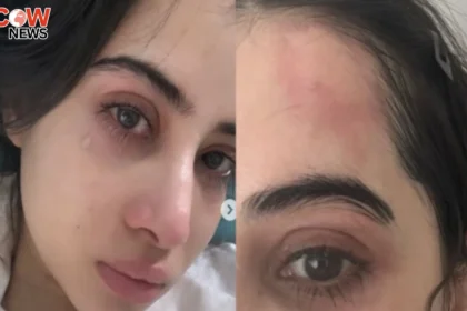 Urfi Javeds Tearful Photo with Injury Sparks Concern