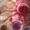 Certain Blood Groups Linked to Higher Stomach Cancer Risk