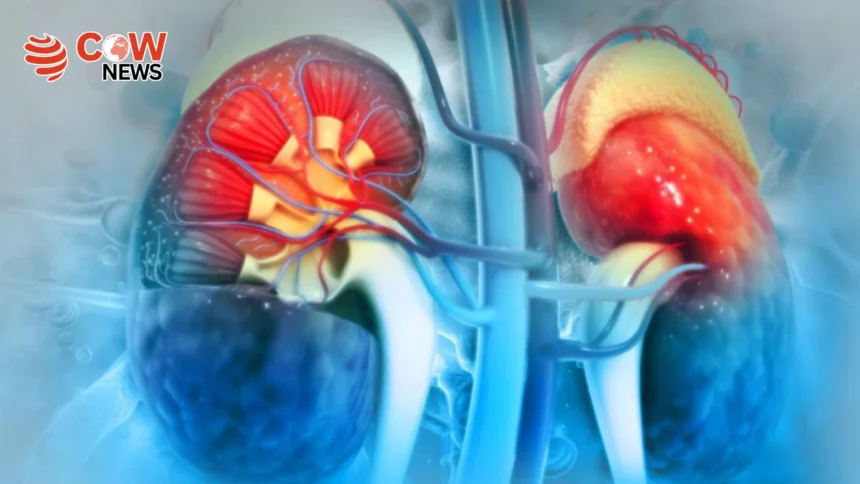 Kidney Diseases Rising Globally 10 Ways to Stay Healthy