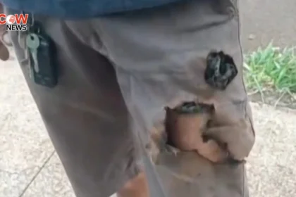 Mobile Phone Saves Brazilian Man From Dog Attack