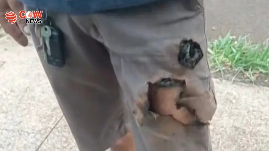 Mobile Phone Saves Brazilian Man From Dog Attack