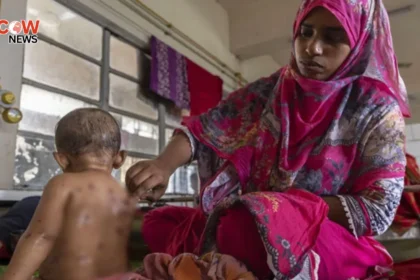Measles Outbreak Claims 98 Children in Bangladesh