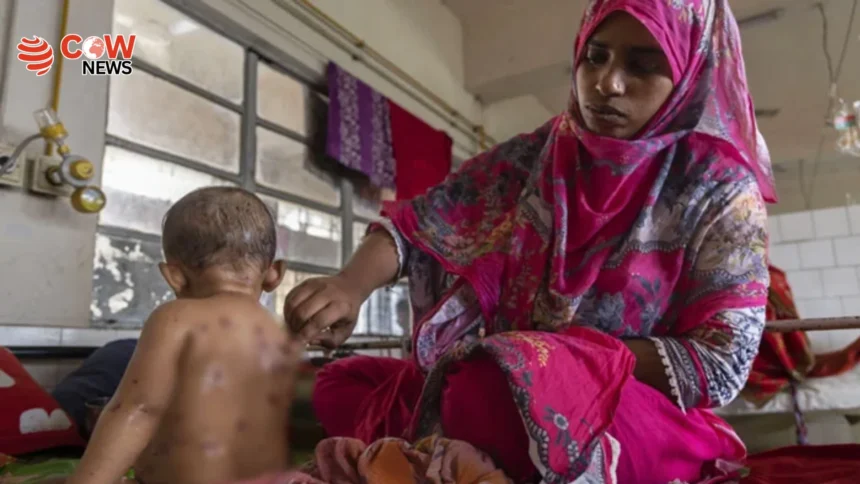 Measles Outbreak Claims 98 Children in Bangladesh