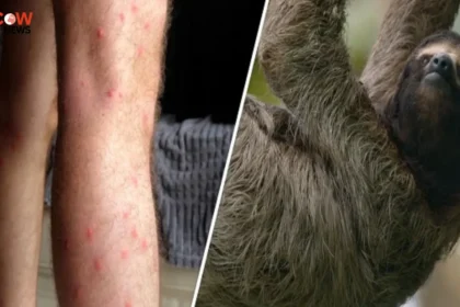 Scientists Warn of Wider Spread of Rare Virus Infection - The COW News